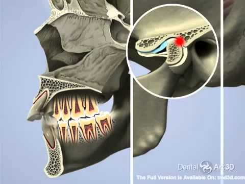 Airway and TMJ English thumbnail